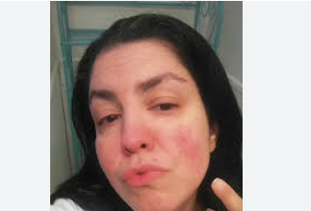 https://fibromyalgia.space/