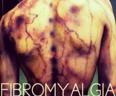 https://fibromyalgia.space/