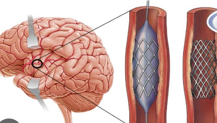 https://fibromyalgia.space/