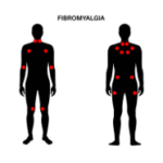 https://fibromyalgia.space/