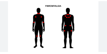 https://fibromyalgia.space/
